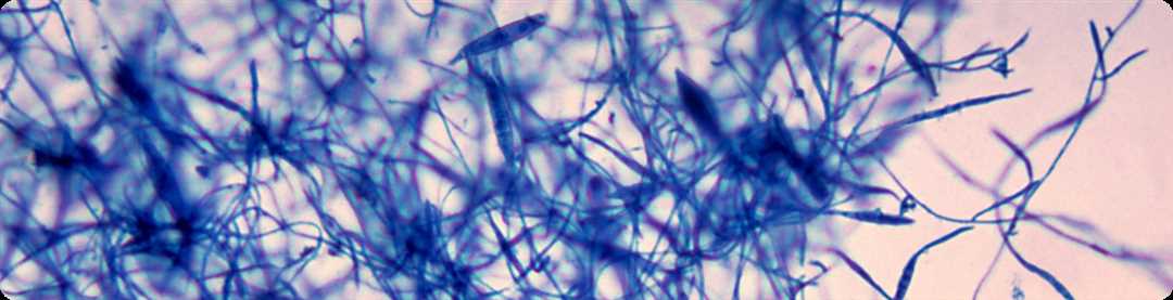 Микроскопическое исследование биоматериала волосы, ногти, соскоб кожи на патогенные грибы на стекле